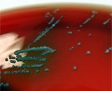 Выявлен первый случай передачи микробов от человека растению