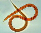 В ДНК червей найден выключатель старости