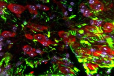 PNAS Nexus: Найден белок, способный исцелить мозг после травмы