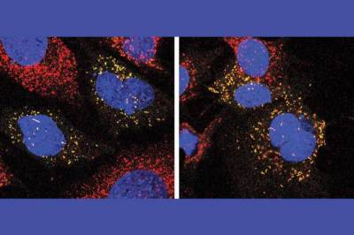 Улучшение рециркуляции клеток поможет лечить нейродегенеративные заболевания