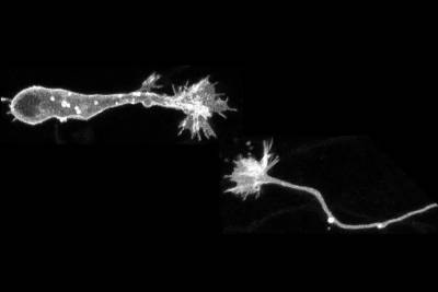 Nature Communications: В мигрирующих нейронах найден конус роста