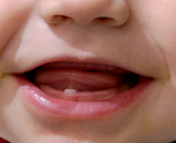 Обнаружены гены, отвечающие за раннее формирование зубов