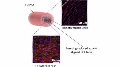 Ученые добились прогресса в области тканевой инженерии кровеносных сосудов