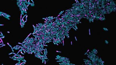 Ученые разгадали тайну организации бактерий перед делением клетки