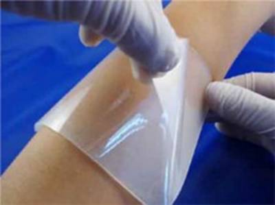 Composites Part B: Engineering: Ученые создают новые гидрогели для лечения ран